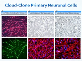 Cloud-Clone、全系統多種初代神経細胞ラインナップの グローバルローンチを予定