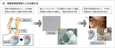 富士フイルムと東京医科歯科大学　半月板損傷を対象とした、世界初の自家間葉系幹細胞移植技術に関する特許ライセンス契約を締結