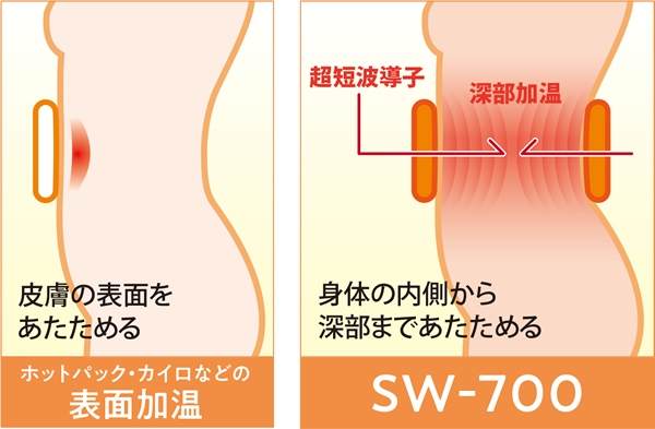 表面加温と超短波による深部加温の比較イメージ