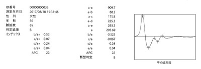 印刷:平均波形
