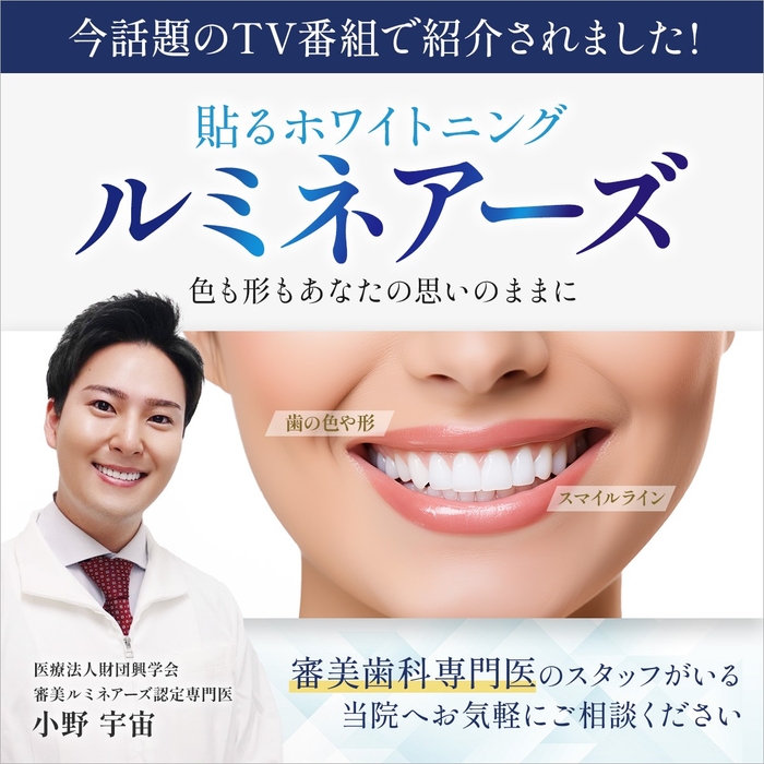 ルミネーズ(貼るホワイトニング)
