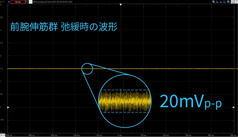 MyoScan計測データ