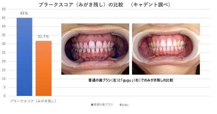 プラークスコア(みがき残し)の比較 (キャデント調べ)