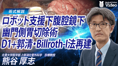 ロボット支援下腹腔鏡下幽門側胃切除術 D1＋郭清 Billroth-I法再建