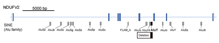 図4 Alu因子を介したNDUFV2遺伝子の欠失　Alu因子はゲノム上に複数存在しますが、この症例ではイントロン5のAluYの位置に別のAluYa5が移動してきて、それに伴いイントロン4までにおよぶ遺伝子欠失が生じていました。