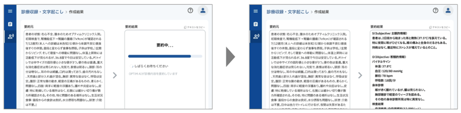 医師向け|カルテの作成支援(2025年春~夏 リリース予定)