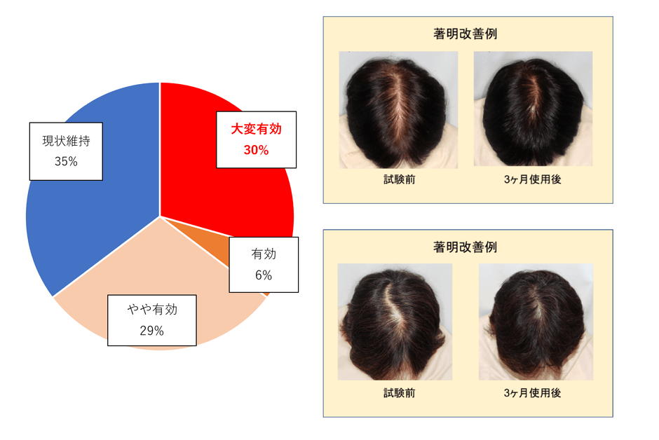 図3：週に1回の冷却刺激により65％のヒトに育毛効果を確認