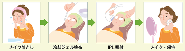 手順