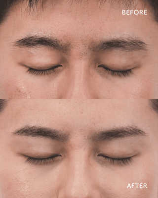 男性ビフォーアフター