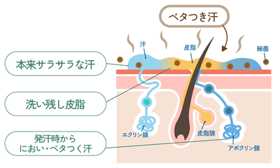 「洗い残し皮脂」とお風呂上がりの「サラサラ汗」が合体し、ベタつき汗に