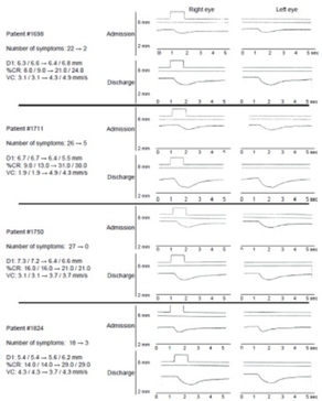瞳孔機能検査(副交感神経機能の評価)