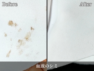 血液のしみ抜きビフォーアフター