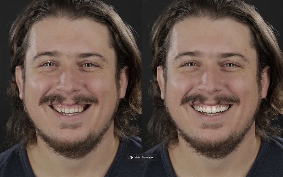 ビフォー＆アフター