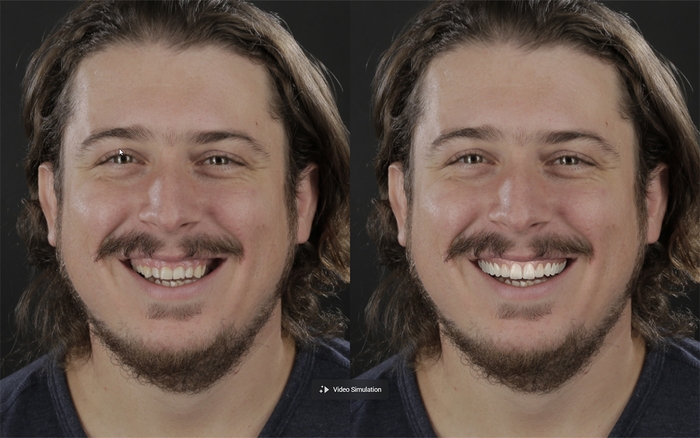 ビフォー＆アフター