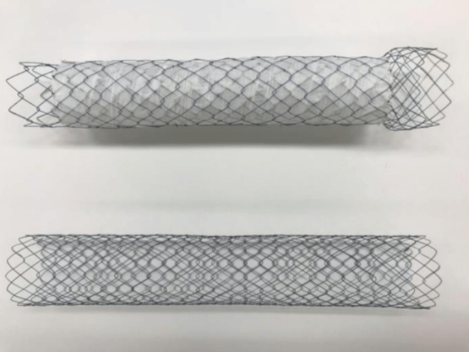 今回の多施設無作為化比較試験で使用した2種類のステント　上：胃十二指腸用カバー付きステント、下：胃十二指腸用カバーなしステント