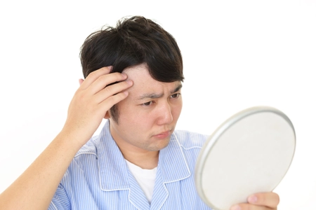 10代～60代の男女それぞれ200人に薄毛に関するアンケート実施 　他人の髪が気になる人は男女ともに約半数！ 本人にそのことを伝えられる？