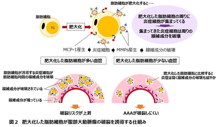 図２　肥大化した脂肪細胞が腹部大動脈瘤の破裂を誘導する仕組み