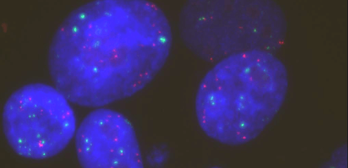 治療抵抗性獲得後の肺がん細胞モデル