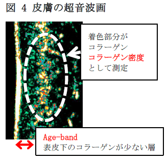 図4 皮膚の超音波画