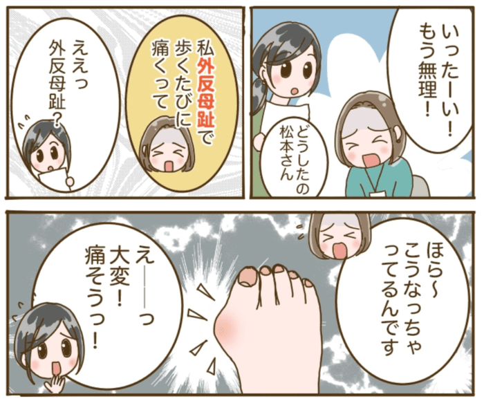 マンガでわかる！外反母趾の痛み