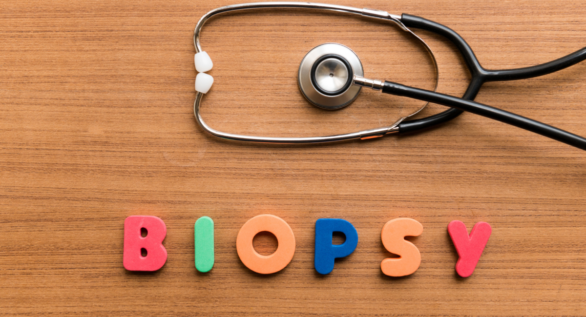 リキッドバイオプシーの世界市場規模は2026年までに33億6260万ドル、年率21.9%に達する見込み