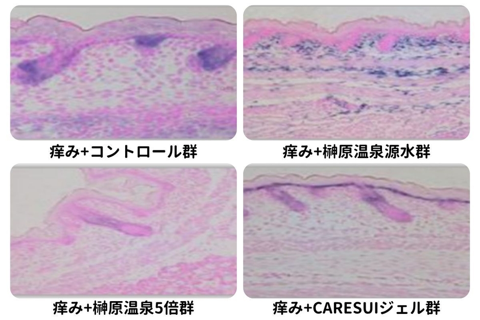図1：痒みを発生させた皮膚のH&E染色の画像による分析