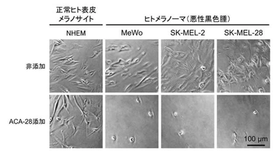 皮膚がんの一種「メラノーマ（悪性黒色腫）」の増殖を選択的に阻害する化合物を発見　がん化した細胞を標的とした副作用の少ない抗がん剤開発に期待