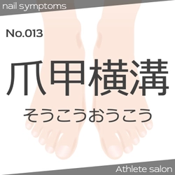 爪がでこぼこするのは一体なぜ？？爪甲横溝の原因と予防方法を解説。強い爪に導くコツを公開