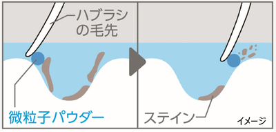 歯の表面のミクロなキズに残った汚れ除去(2)