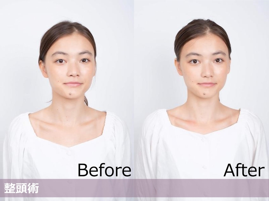 ビフォーアフター