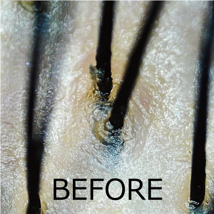 毛穴シャンプー使用前