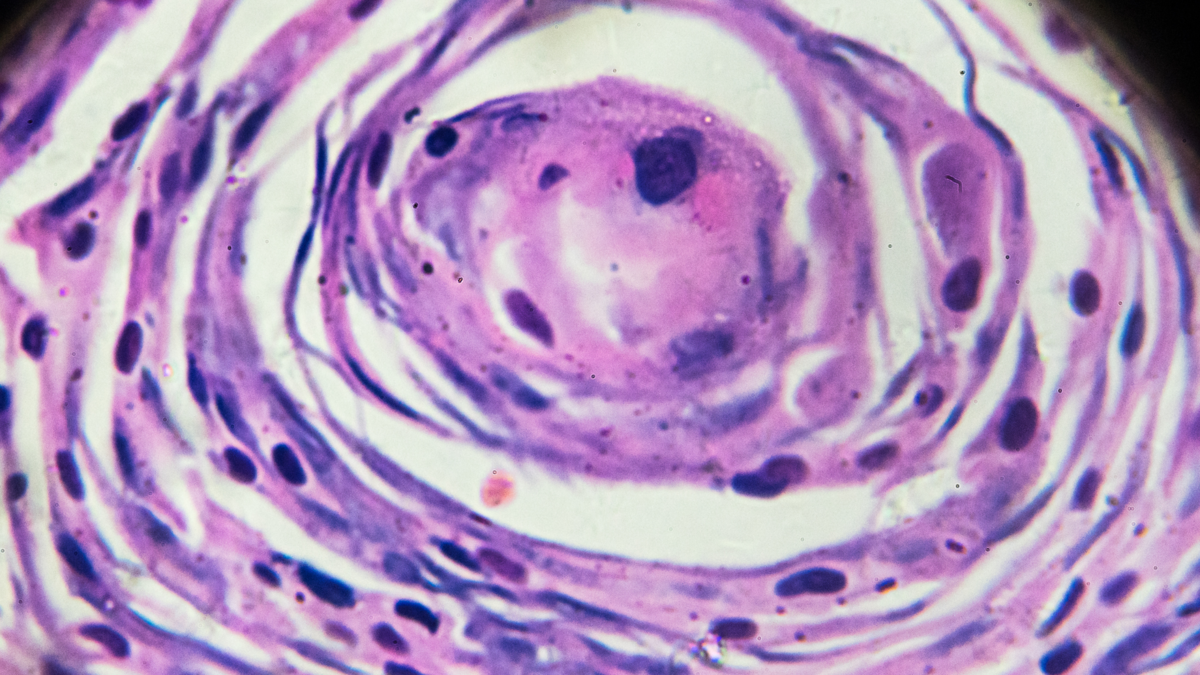 子宮頸部異形成の市場規模は2028年までに9億5500万米ドルに達する見込み