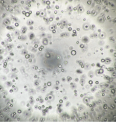 ヒト膵がん患者由来オルガノイドの増殖試験(8日後)　b) 既存ポリスチレン製プレート／地方独立行政法人大阪府立病院機構大阪国際がんセンター 平塚 徹 チームリーダー ご提供