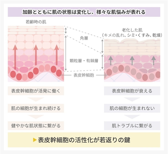 肌悩みの要因