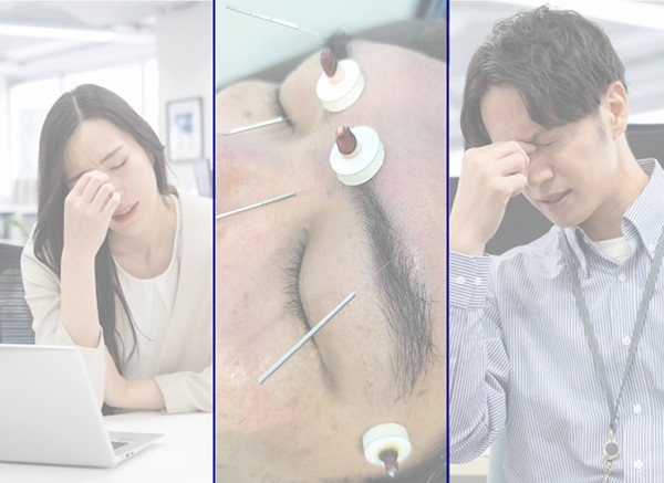 「頭専門」だからこそ見える、深刻な眼精疲労の現実。PC作業による蓄積した疲労を、鍼灸師の専門技術で根本からケア。