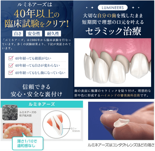 削らない・痛みの少ない「ルミネアーズ」審美歯科治療