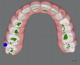 顔の左右差の原因は“加齢”だけではない？