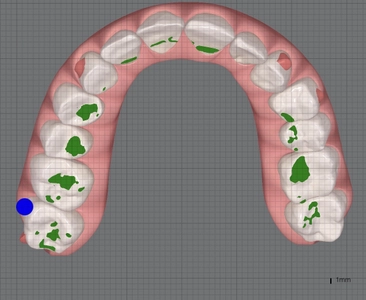 顔の左右差の原因は“加齢”だけではない？