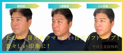 元東京ヤクルトスワローズ監督・真中満氏が共立美容外科で実感！ 自然なクマ取りで若々しい印象へ