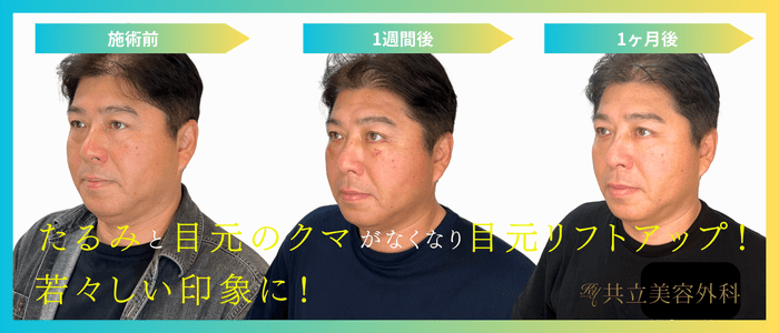 真中満氏クマ取り治療