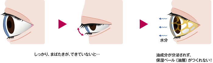 まばたき不全