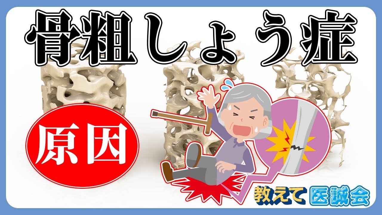 「教えて医誠会」新動画シリーズ公開　骨粗しょう症を3回にわたり解説！6月4日スタート