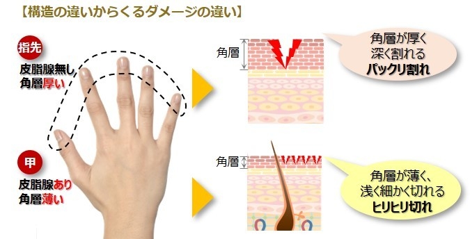 指先と手の甲の構造の違い