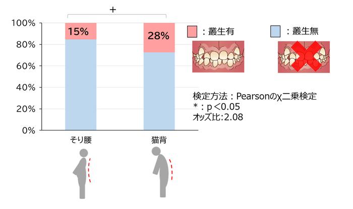 図2 叢生と姿勢の関連性