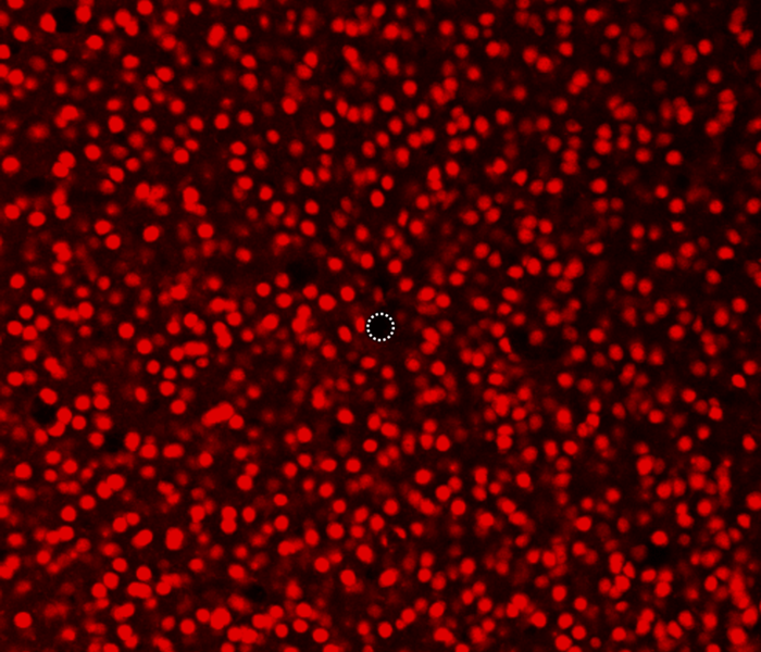 図:直径5 µmマイクロニードル電極周辺の神経細胞(ニューロン)の観察