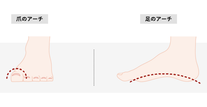 ２つのアーチが巻き爪を改善へと導く（ダブルアーチ理論）