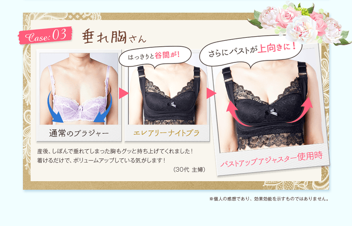 使用者の感想：Case03 垂れ胸さん