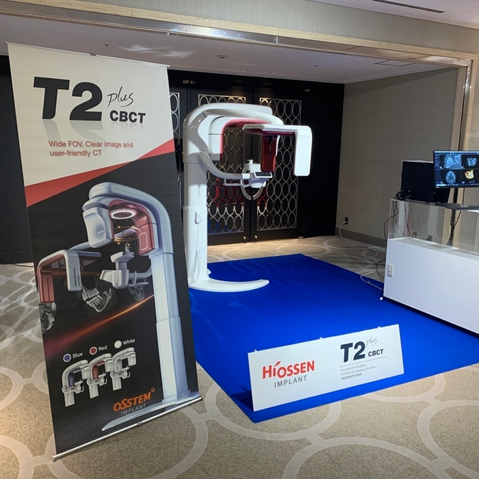 図7:CBCT T2plus(ティーツープラス)の展示