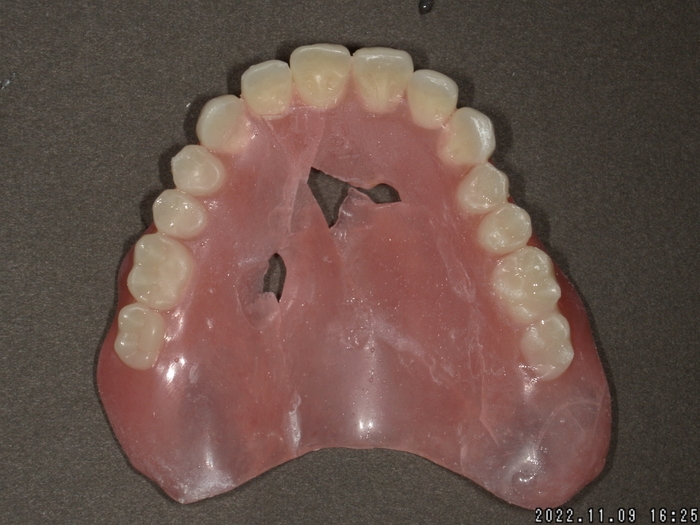 4. T様-2 部品を合わせてみたものの。。。欠けがある部分は修復します