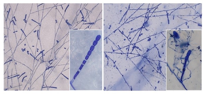 世界初！菌寄生菌による農薬耐性うどんこ病菌の感染拡大防止を確認　うどんこ病防除法の開発と農薬使用量の低減に期待